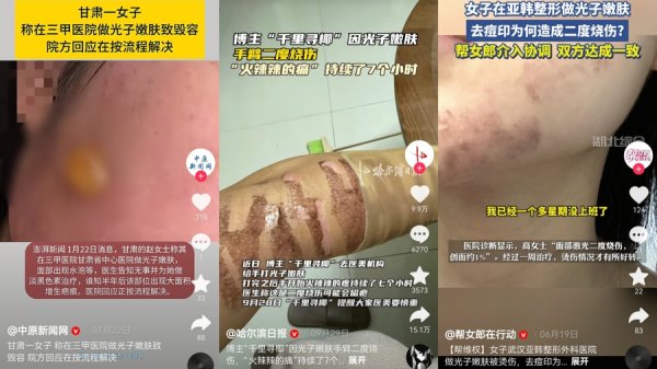 有富策略 秋季是光子嫩肤黄金季节？勿轻信！烧伤事故频发